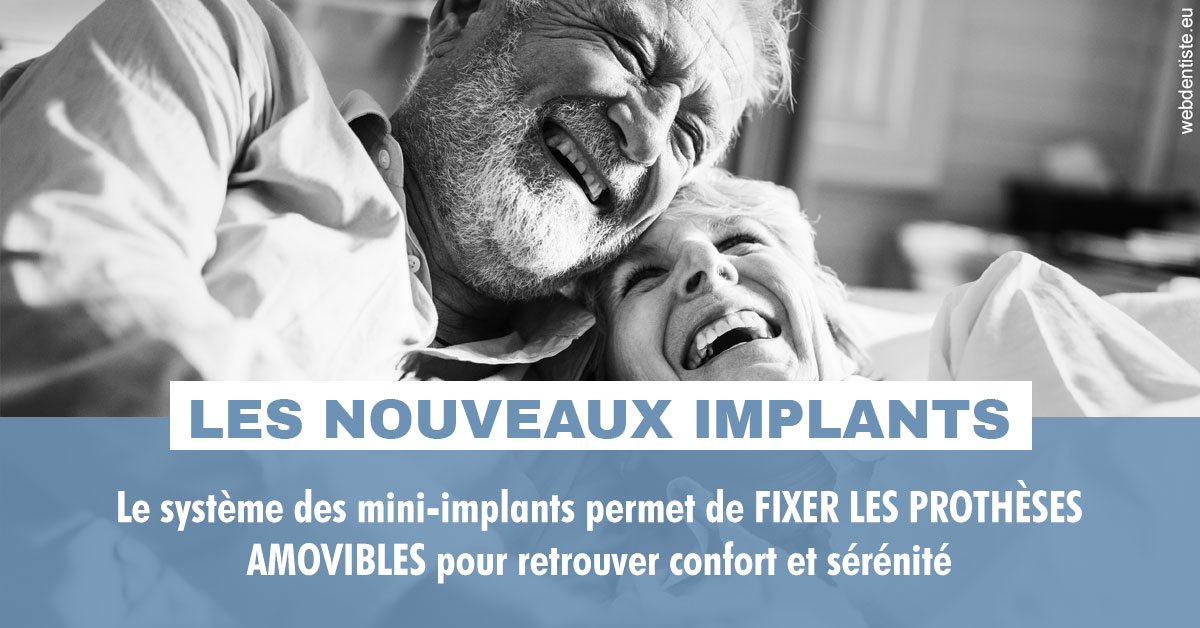 https://dr-landreau-franck.chirurgiens-dentistes.fr/Les nouveaux implants 2