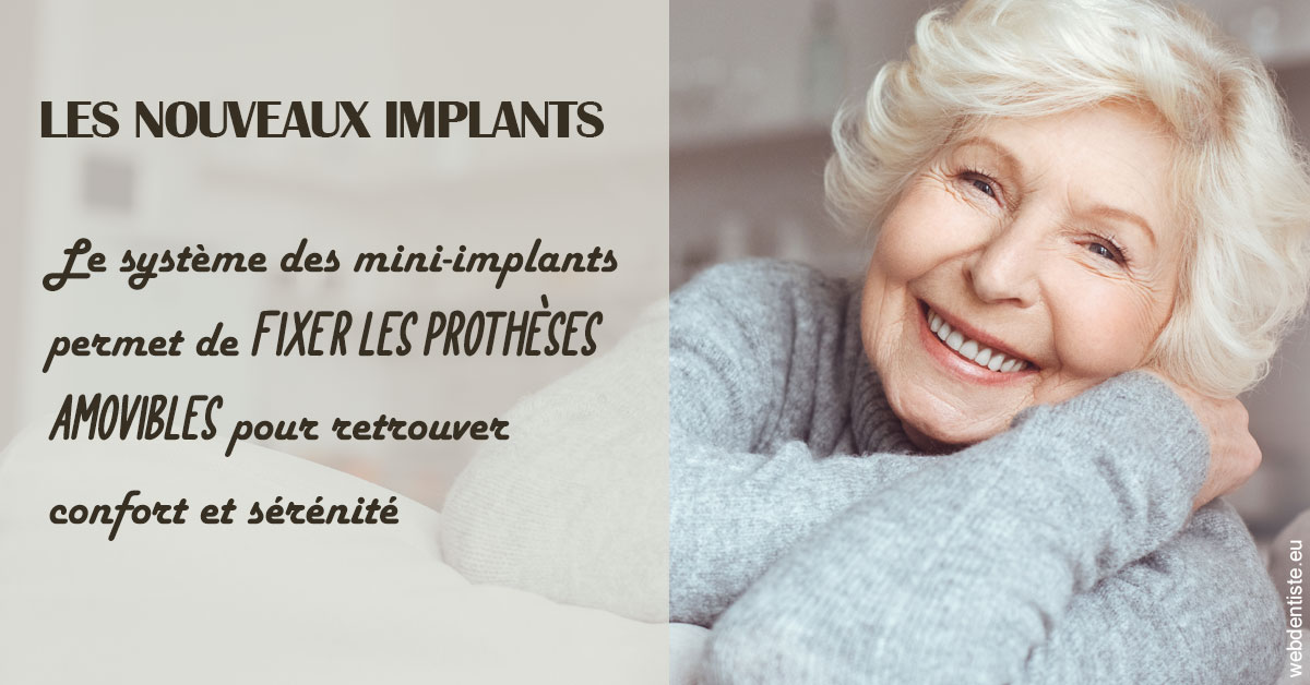 https://dr-landreau-franck.chirurgiens-dentistes.fr/Les nouveaux implants 1