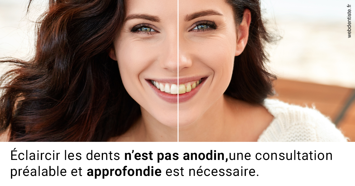 https://dr-landreau-franck.chirurgiens-dentistes.fr/Le blanchiment 2