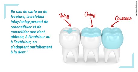 https://dr-landreau-franck.chirurgiens-dentistes.fr/L'INLAY ou l'ONLAY