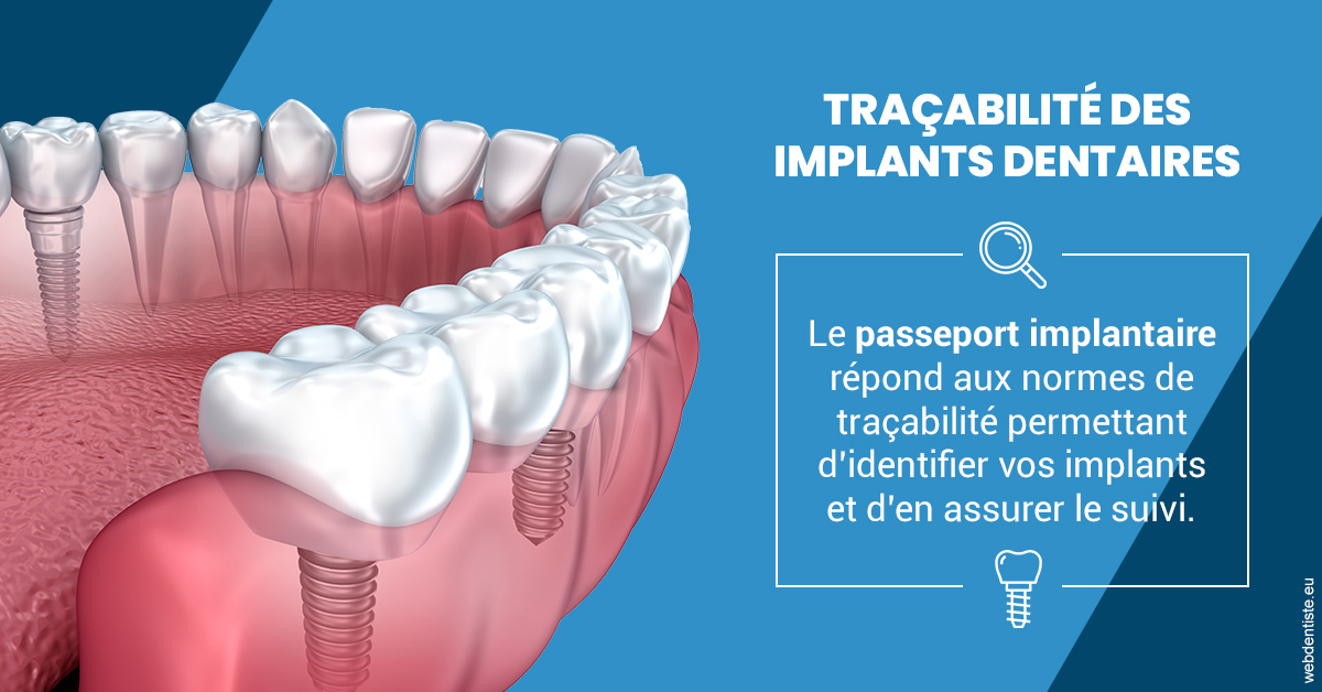 https://dr-landreau-franck.chirurgiens-dentistes.fr/T2 2023 - Traçabilité des implants 1