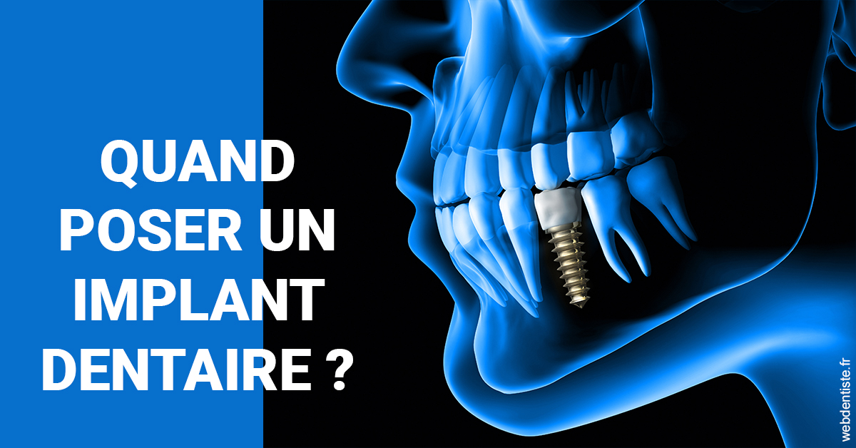 https://dr-landreau-franck.chirurgiens-dentistes.fr/Les implants 1