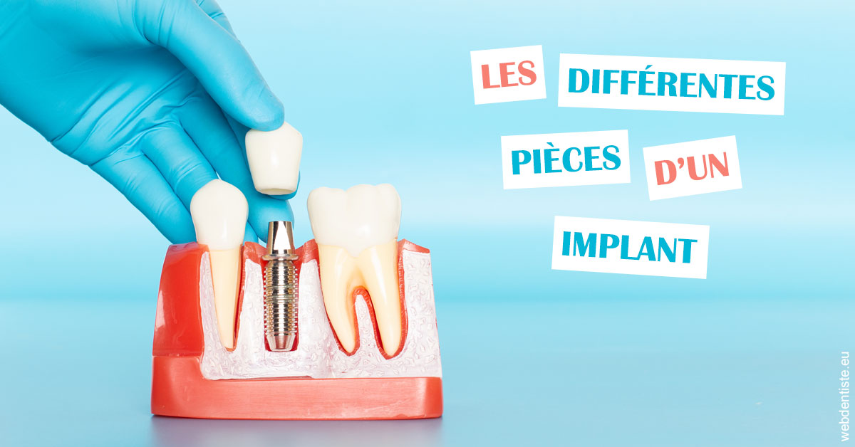 https://dr-landreau-franck.chirurgiens-dentistes.fr/Les différentes pièces d’un implant 2