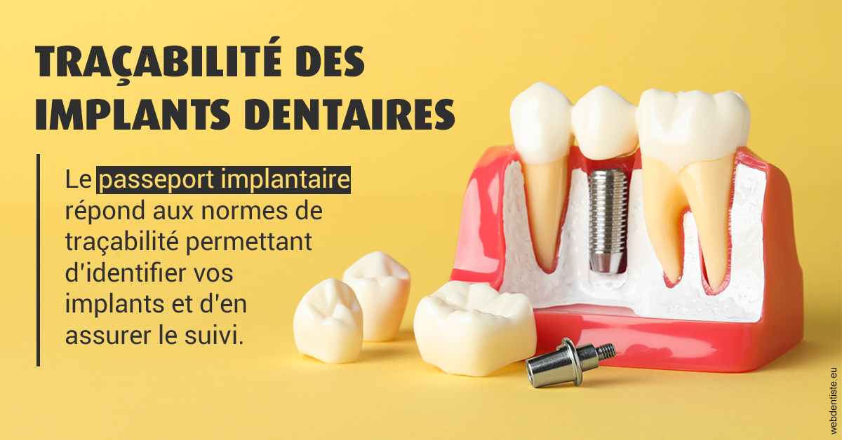 https://dr-landreau-franck.chirurgiens-dentistes.fr/T2 2023 - Traçabilité des implants 2