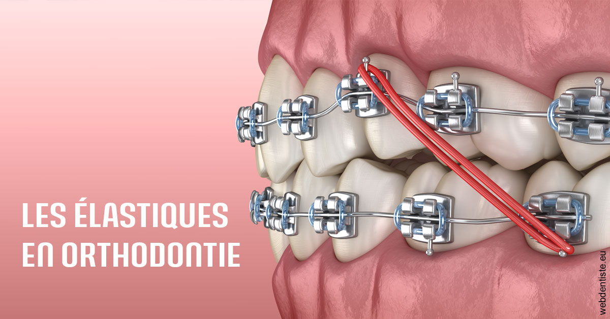 https://dr-landreau-franck.chirurgiens-dentistes.fr/Elastiques orthodontie 2
