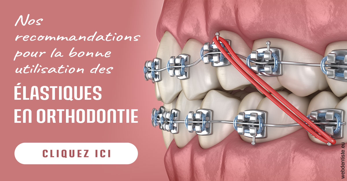 https://dr-landreau-franck.chirurgiens-dentistes.fr/Elastiques orthodontie 2